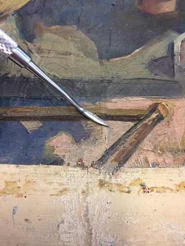 Consolidation of a crack in the oil paint: the edges of the crack are gently pushed down to reduce the gap